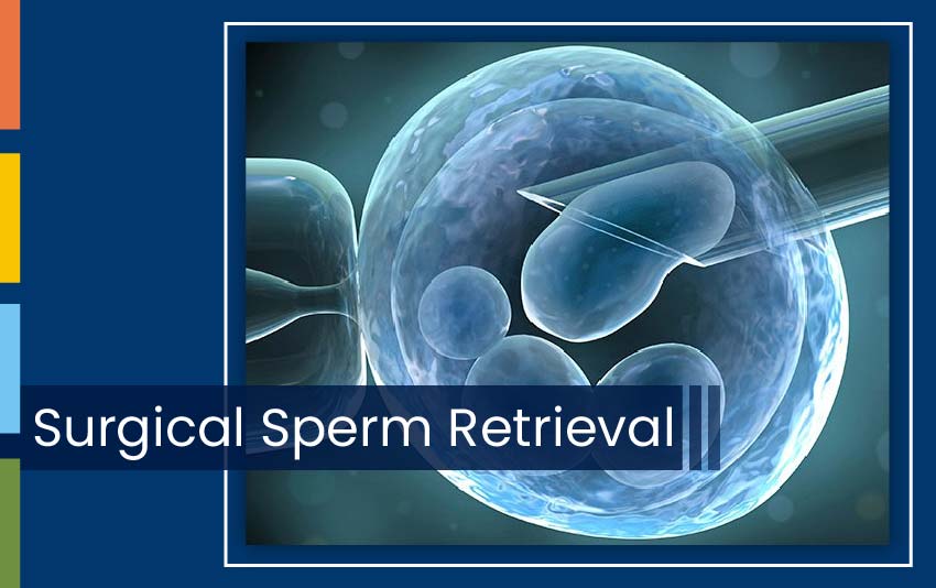 SURGICAL SPERM RETRIEVAL - Orkid Medilife Hospital