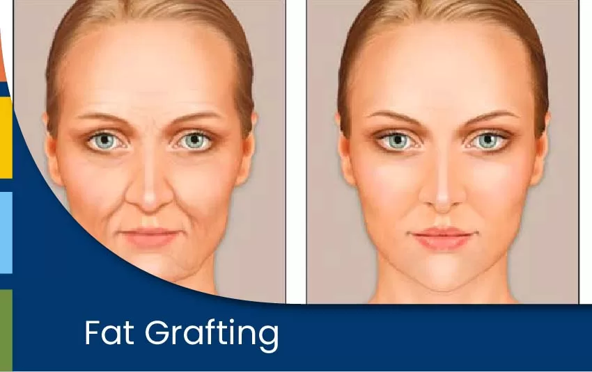 Fat Grafting Orkid Medilife Hospital