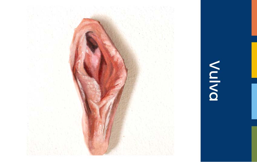 vulva-orkid-medilife-hospital